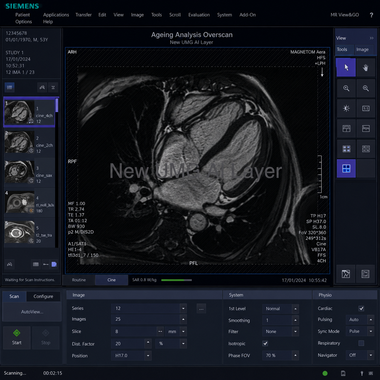 New UMG AI Layer cardiac ageing analysis interface